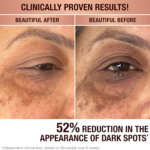 SERUM ZUR KORREKTUR VON PIGMENTFLECKEN UND ZUR WIEDERHERSTELLUNG DER AUSSTRAHLUNG 30 ML
