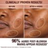 SERUM ZUR KORREKTUR VON PIGMENTFLECKEN UND ZUR WIEDERHERSTELLUNG DER AUSSTRAHLUNG 30 ML